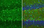 S100B Antibody in Immunohistochemistry (Paraffin) (IHC (P))