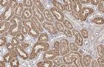 SLC27A2 Antibody in Immunohistochemistry (Paraffin) (IHC (P))