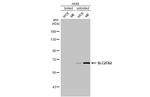 SLC27A2 Antibody in Western Blot (WB)