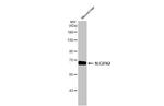 SLC27A2 Antibody in Western Blot (WB)