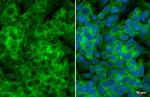 YTHDF3 Antibody in Immunocytochemistry (ICC/IF)