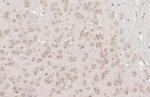 YTHDF3 Antibody in Immunohistochemistry (Paraffin) (IHC (P))