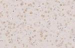 YTHDF3 Antibody in Immunohistochemistry (Paraffin) (IHC (P))