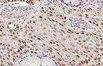 p53 Antibody in Immunohistochemistry (Paraffin) (IHC (P))