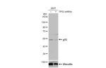 p53 Antibody in Western Blot (WB)