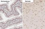 ZEB1 Antibody in Immunohistochemistry (Paraffin) (IHC (P))