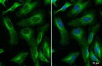 RIP1 Antibody in Immunocytochemistry (ICC/IF)