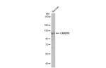 CARD10 Antibody in Western Blot (WB)