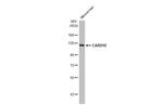 CARD10 Antibody in Western Blot (WB)