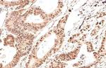 CHOP Antibody in Immunohistochemistry (Paraffin) (IHC (P))