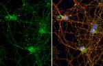 Stargazin Antibody in Immunocytochemistry (ICC/IF)