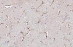 Stargazin Antibody in Immunohistochemistry (Paraffin) (IHC (P))