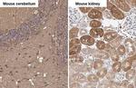 Glutamine Synthetase Antibody in Immunohistochemistry (Paraffin) (IHC (P))