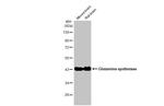 Glutamine Synthetase Antibody in Western Blot (WB)