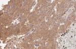 VEGFC Antibody in Immunohistochemistry (Paraffin) (IHC (P))