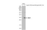 SNAIL Antibody in Western Blot (WB)