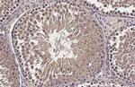 CP110 Antibody in Immunohistochemistry (Paraffin) (IHC (P))