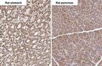 TLR3 Antibody in Immunohistochemistry (Paraffin) (IHC (P))