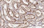 ST6GAL1 Antibody in Immunohistochemistry (Paraffin) (IHC (P))