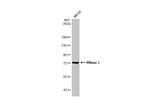 RNaseL Antibody in Western Blot (WB)