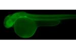 PELO Antibody in Immunohistochemistry (IHC)