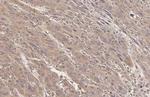 SERCA2 ATPase Antibody in Immunohistochemistry (Paraffin) (IHC (P))