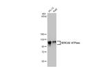 SERCA2 ATPase Antibody in Western Blot (WB)