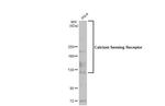 Calcium Sensing Receptor Antibody in Western Blot (WB)