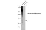 Calcium Sensing Receptor Antibody in Western Blot (WB)