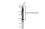 Calcium Sensing Receptor Antibody in Western Blot (WB)