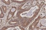 RANBP1 Antibody in Immunohistochemistry (Paraffin) (IHC (P))