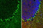 Calbindin D28K Antibody in Immunohistochemistry (Paraffin) (IHC (P))