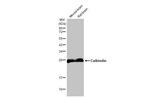 Calbindin D28K Antibody in Western Blot (WB)