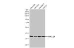 SUCLG1 Antibody in Western Blot (WB)