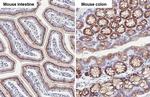 GALNT6 Antibody in Immunohistochemistry (Paraffin) (IHC (P))