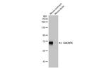 GALNT6 Antibody in Western Blot (WB)