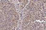 uPAR Antibody in Immunohistochemistry (Paraffin) (IHC (P))