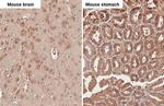 uPAR Antibody in Immunohistochemistry (Paraffin) (IHC (P))