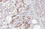 CXCR4 Antibody in Immunohistochemistry (Paraffin) (IHC (P))