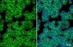 CXCR4 Antibody in Immunocytochemistry (ICC/IF)