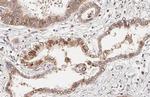 CXCR4 Antibody in Immunohistochemistry (Paraffin) (IHC (P))