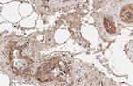 CXCR4 Antibody in Immunohistochemistry (Paraffin) (IHC (P))