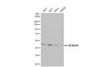 BCKDHA Antibody in Western Blot (WB)