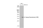 Human Parechovirus Type 1/3 VP0 Antibody in Western Blot (WB)