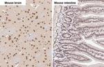 FUS Antibody in Immunohistochemistry (Paraffin) (IHC (P))