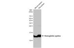 HBE1 Antibody in Western Blot (WB)