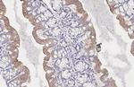 SMYD3 Antibody in Immunohistochemistry (Paraffin) (IHC (P))