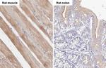 SMYD3 Antibody in Immunohistochemistry (Paraffin) (IHC (P))