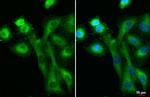 IFIT3 Antibody in Immunocytochemistry (ICC/IF)