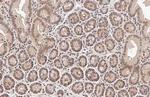 PIN1 Antibody in Immunohistochemistry (Paraffin) (IHC (P))